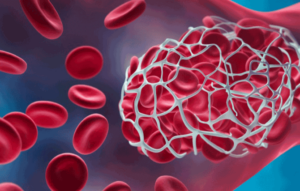 graphic-blood-clot-cropped