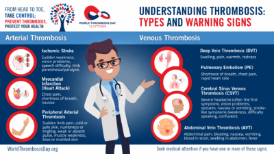 Arterial thrombosis signs and symptoms fact sheet
