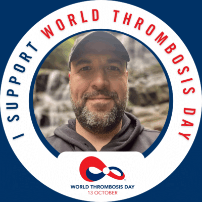 Carly Weinstein and life after blood clots