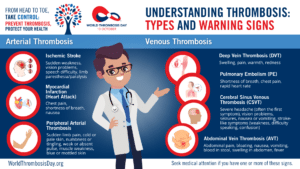 World Thrombosis Day patient fact sheet about blood clot signs and symptoms